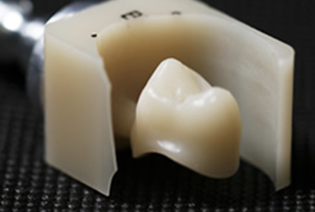 ジルコニアボンド